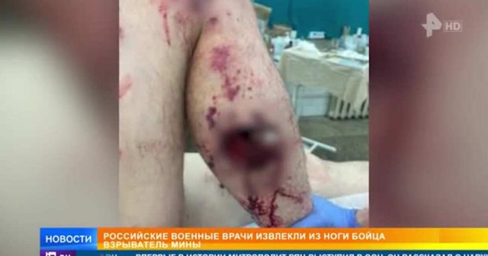 ������� ����� ������� ���������� ���� �� ���� ��������� ������������