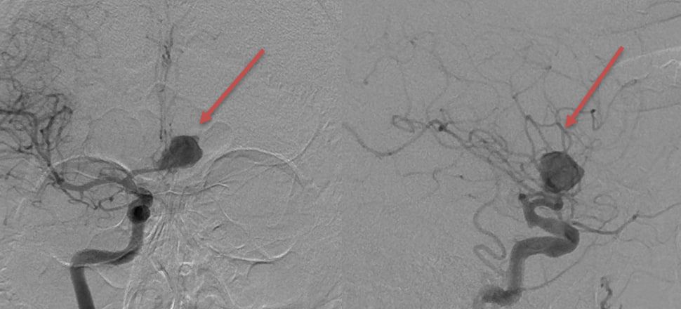 � ��� ������� �������������� ������� � ������� ������� ����������