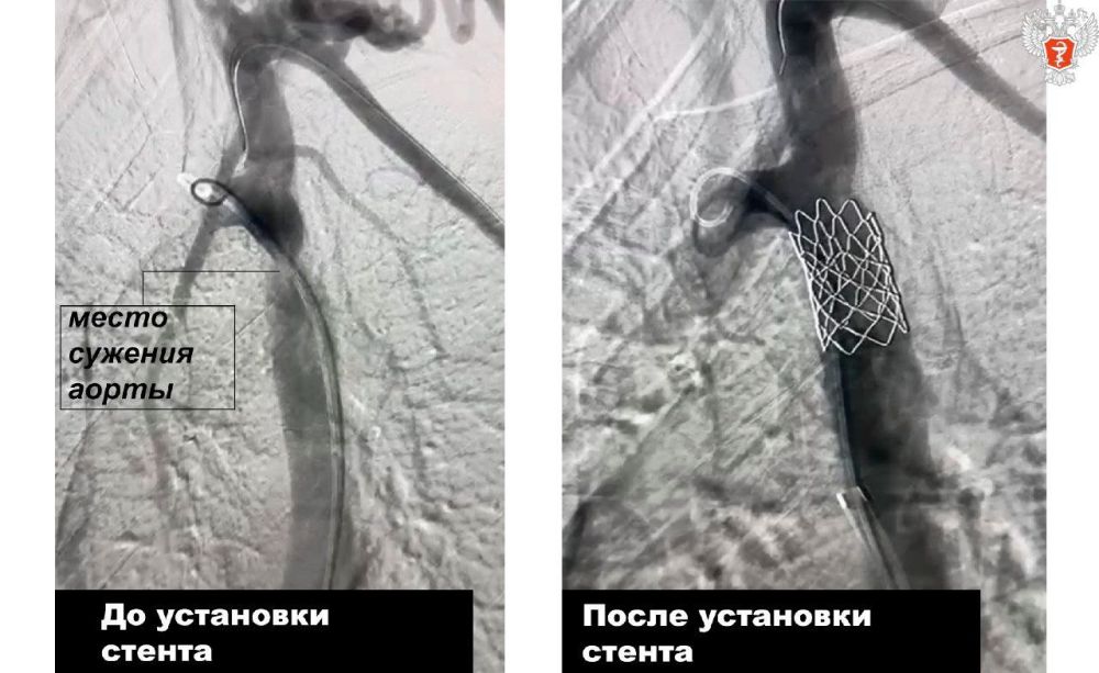 ������������� ����� ������ 14-������� ��������� � �������� ������� �� ���