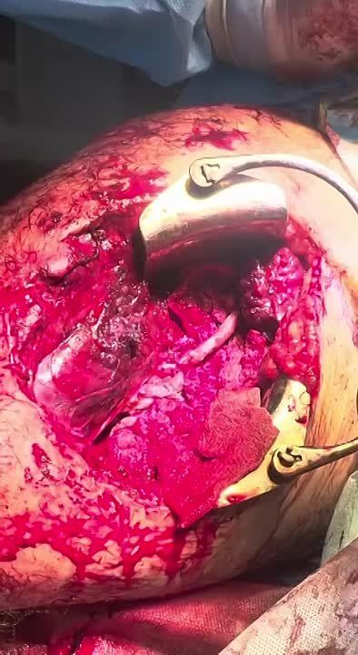 �������� �� �������� ���� �������