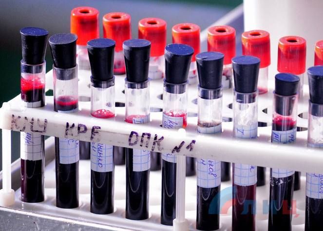 ����� 36 ���. ������� ��������� �������� ���������� � �������� ���� ����� �������� ����� � �� �����������. �� ���� � �������� ��� ������� ������� ���� ��������� ��������������� ������� ����������� ����� ������ �����