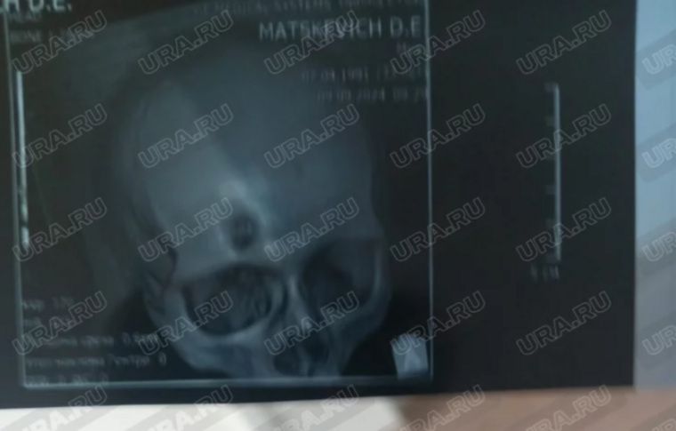 ���� ��� �� ������������� � ����� � ������ ����� � ����������� ���������. ����