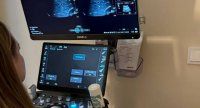 Республиканская больница получила современное оборудование для УЗИ-диагностики