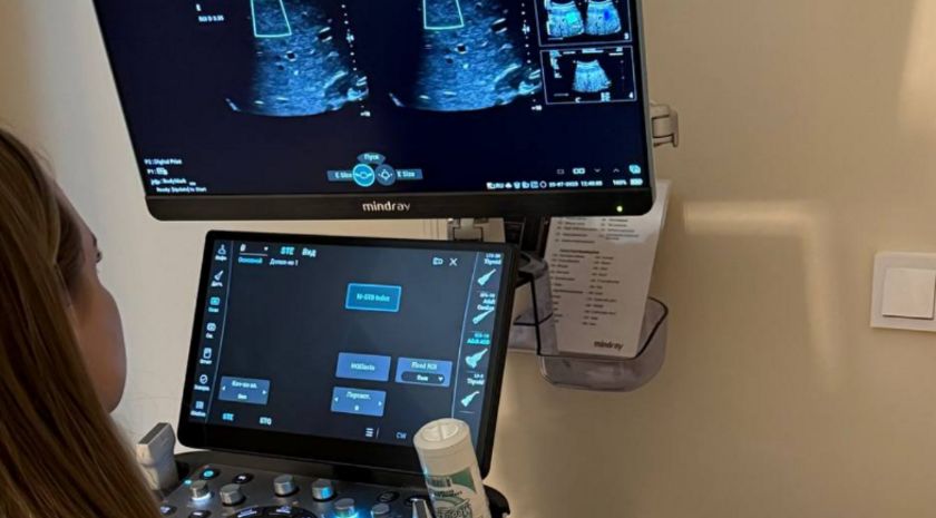 Республиканская больница получила современное оборудование для УЗИ-диагностики — Пащенко