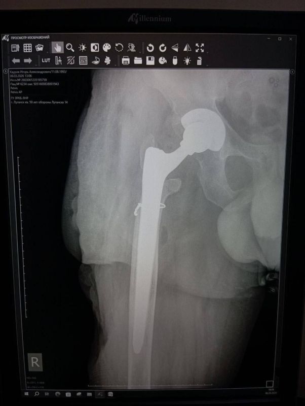 ���������� ��������: ����� �������� ������� �������� ��� ����������� ������ ��� �������