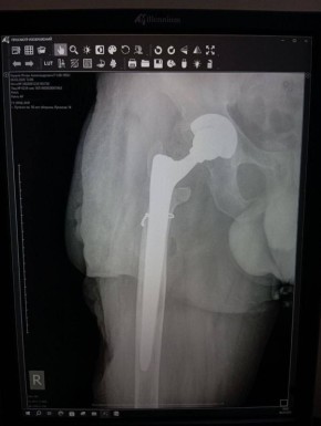 ���������� ��������: ����� �������� ������� �������� ��� ����������� ������ ��� �������