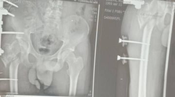 ���������� �������� � ���� ������� �������� ��� ����������� ������ ��� �������