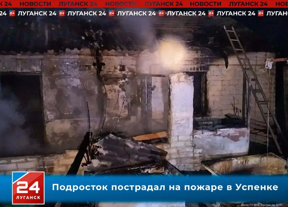 Подросток пострадал на пожаре в Успенке